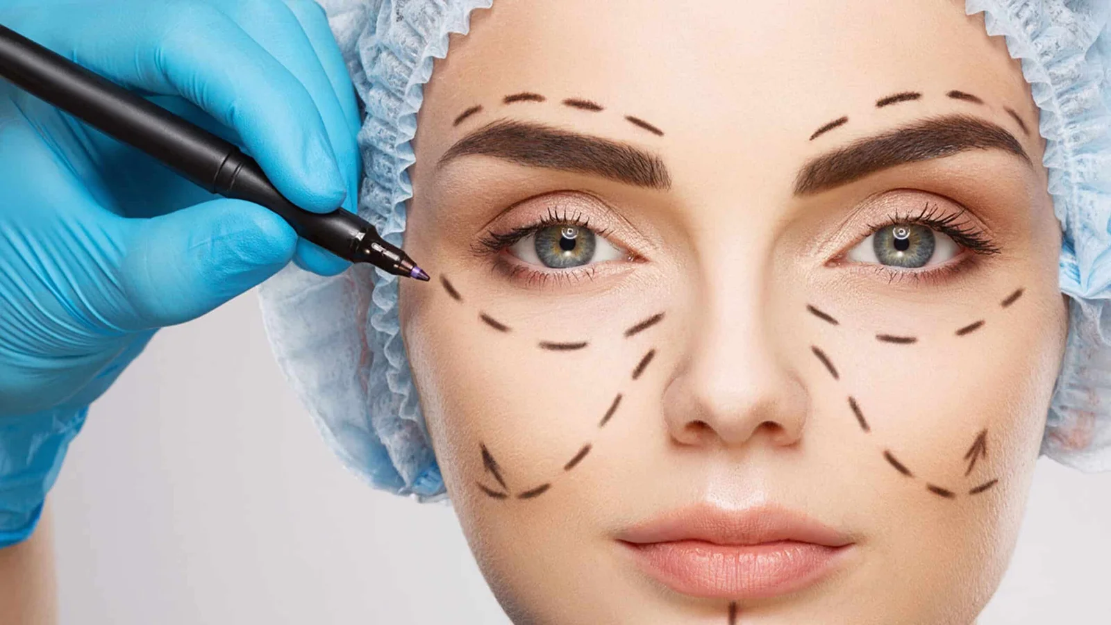 Plastic Surgery